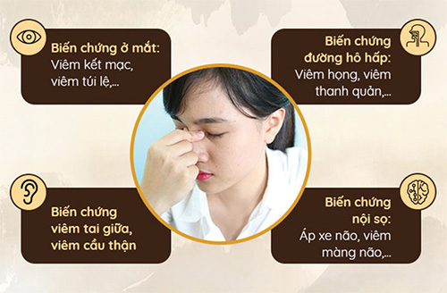 Bệnh viêm xoang có lây không? Có nguy hiểm không? Đâu là cách điều trị hiệu quả? - 2