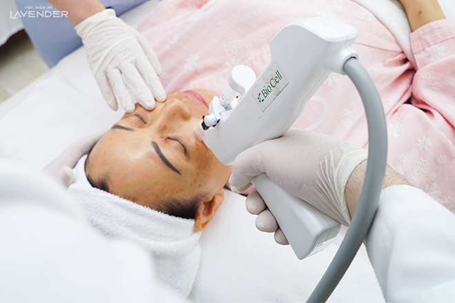 Chị em truyền tai nhau cách trị nám mới: Sạch nám tới 80% mà còn sáng mịn da - 4