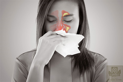 Bệnh viêm xoang mũi có mủ và cách điều trị an toàn, hiệu quả từ thảo dược - 1