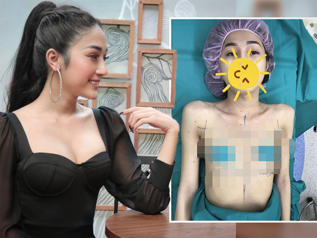 Bạn trẻ - Cuộc sống - Cô gái Sài Thành tung ảnh quá khứ trước khi PTTM gây ngỡ ngàng