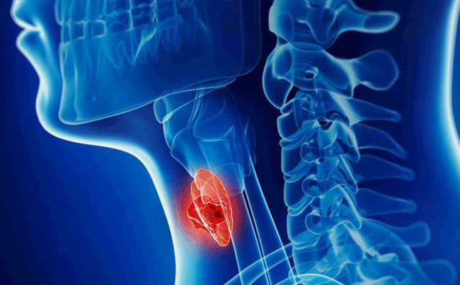 1. Quan hệ tình dục bằng miệng gây ung thư vòm họng: Một nghiên cứu được công bố trên Tạp chí Ung thư lâm sàng Mỹ báo cáo rằng, tỷ lệ ung thư vòm họng tăng ở nước này là do nhiễm trùng HPV mắc phải do quan hệ tình dục đường miệng.
