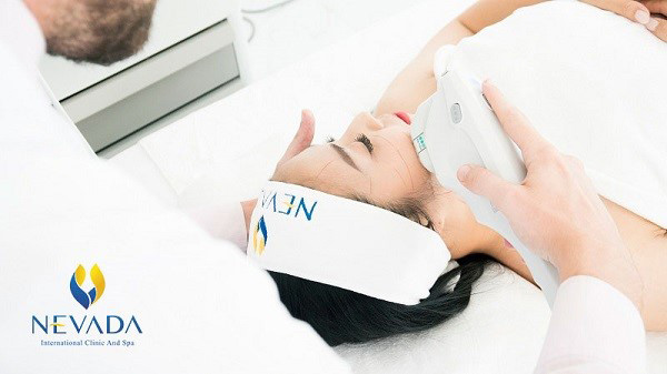 Công nghệ Ultherapy trẻ hóa da nhờ ứng dụng năng lượng thông minh