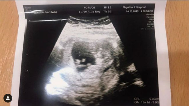 Dangda vui vẻ khoe ảnh vợ mình mang bầu đứa con thứ 2