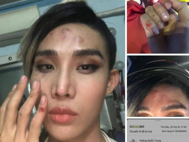 Tin tức trong ngày - Bị tố đánh người mẫu trên phố, tài xế GoViet thanh minh: “Khách quá xấc xược”