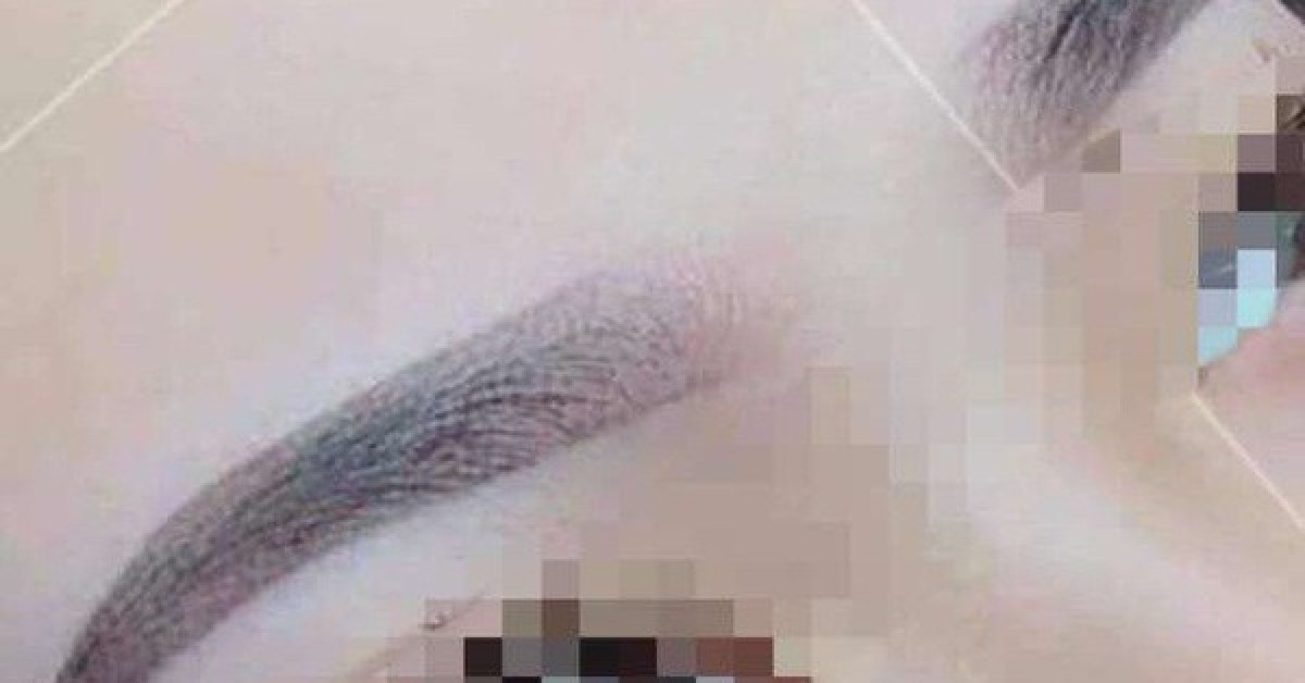 Tin tức trong ngày - Người phụ nữ hôn mê sau xăm chân mày ở TP.HCM đã tử vong