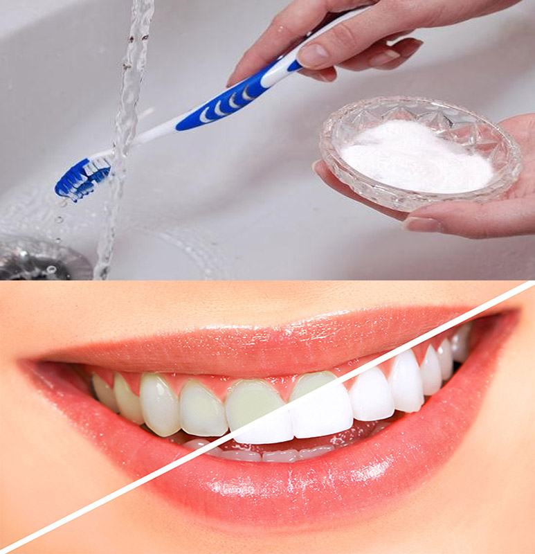 20 Cách làm trắng răng nhanh nhất an toàn hiệu quả tại nhà - 1