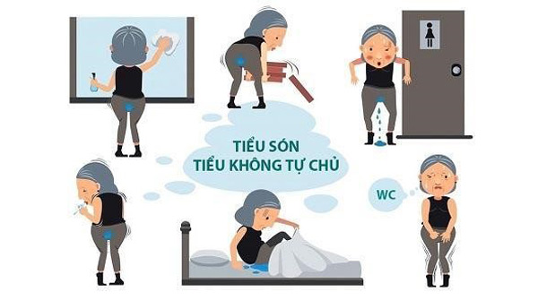 Ho, Hắt hơi là “són tiểu” - Chuyên gia tiết lộ bệnh không ngờ! - 1