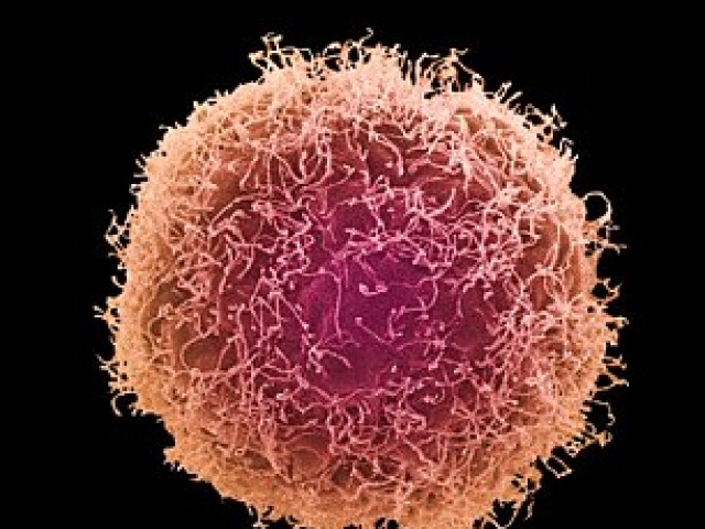 Sức khỏe đời sống - Ung thư dương vật lại nghĩ là do "quan hệ" quá nhiệt tình