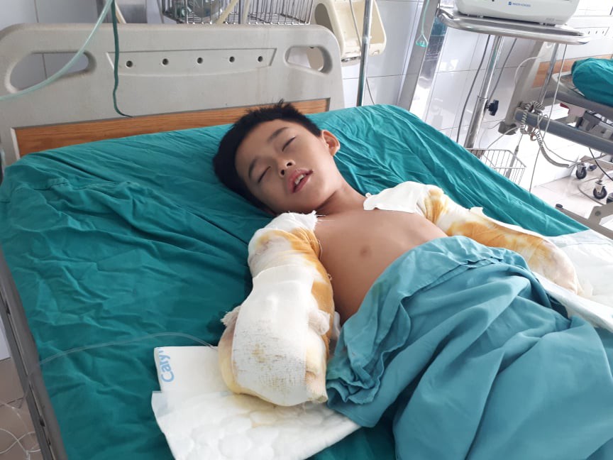 Tay của Long đã bị cắt từ khuỷu tay