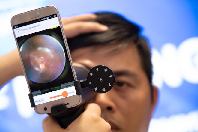 Một hệ thống kiểm tra sức khỏe nhãn khoa gồm kính soi đáy mắt EyeLike,&nbsp;smartphone Samsung và ứng dụng tích hợp AI cài đặt&nbsp;trên smartphone.