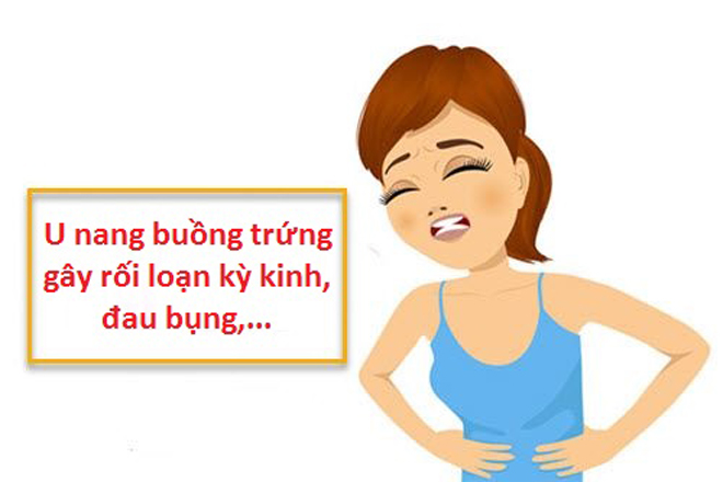 Những điều bạn cần biết về bệnh u nang buồng trứng - 2