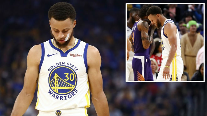 Stephen Curry đối diện nguy cơ gãy tay