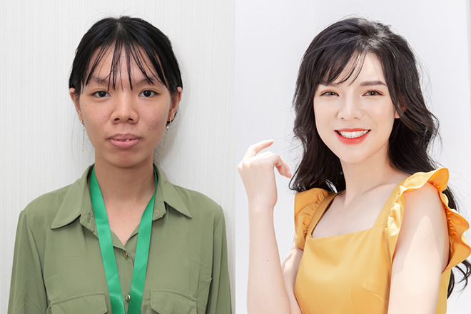 Nguyễn Thẩm Mỹ Diện - Cô gái có tên ngược hẳn với đời, sống "vô thừa nhận", chọn thẩm mỹ để tái sinh - 1