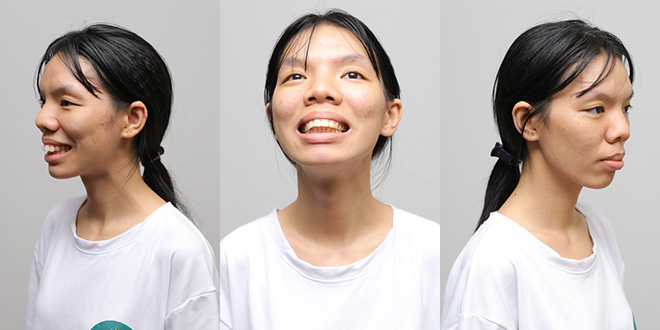 Nguyễn Thẩm Mỹ Diện - Cô gái có tên ngược hẳn với đời, sống "vô thừa nhận", chọn thẩm mỹ để tái sinh - 4