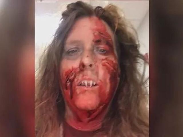 Phi thường - kỳ quặc - Đeo răng giả như xác sống đi chơi Halloween, người phụ nữ hoảng hồn vì không thể gỡ ra