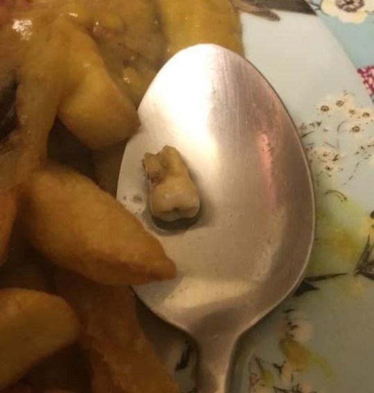 Stephanie khẳng định đó không phải răng của mình (ảnh: Daily Star)