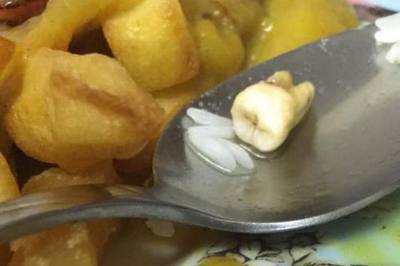 Chiếc răng được tìm thấy trong món cà ri thịt lợn của cô Stephanie (ảnh: Daily Star)