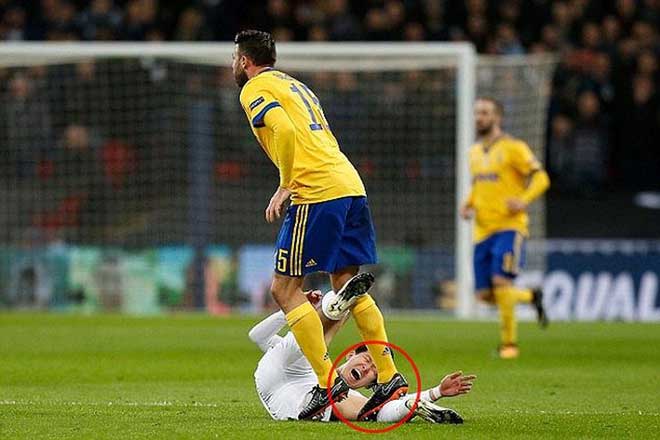 Barzagli dẫm lên chân của Son