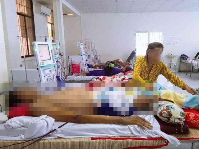 Tin tức trong ngày - Nóng 24h qua: Nguyên nhân người "khổng lồ" cao 2,57m ở Cà Mau qua đời