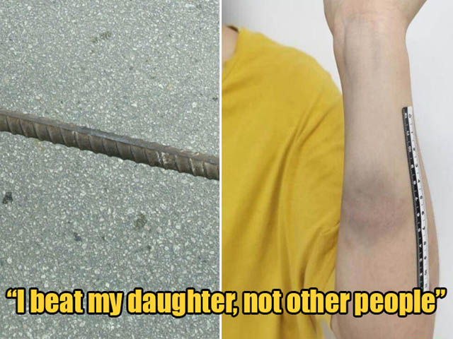 Bạn trẻ - Cuộc sống - Ngoài 30 tuổi vẫn không chịu lấy chồng, cô gái bị mẹ lấy thanh sắt đánh bầm tím