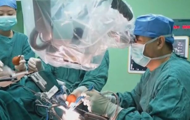 Bác sĩ làm phẫu thuật gắp con sán dây ra khỏi nao bệnh nhân.