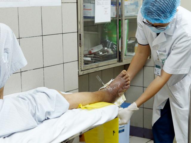 Sức khỏe đời sống - Căn bệnh cứ 8 giây lại có một người chết đang có xu hướng rơi vào những người trẻ tuổi