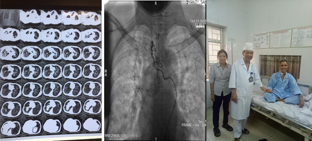 Cụ ông vừa được cứu sống. (Ảnh: Chí Tuấn - SKĐS)