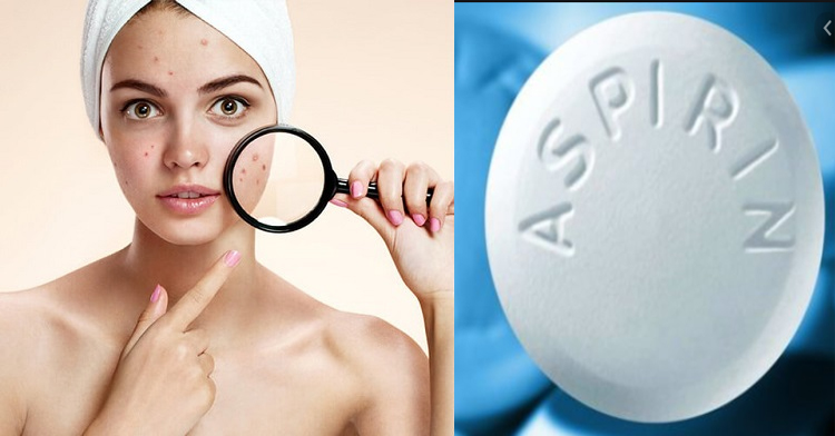 20 Mặt nạ trị mụn tại nhà tốt nhất từ nguyên liệu thiên nhiên dễ kiếm - 7