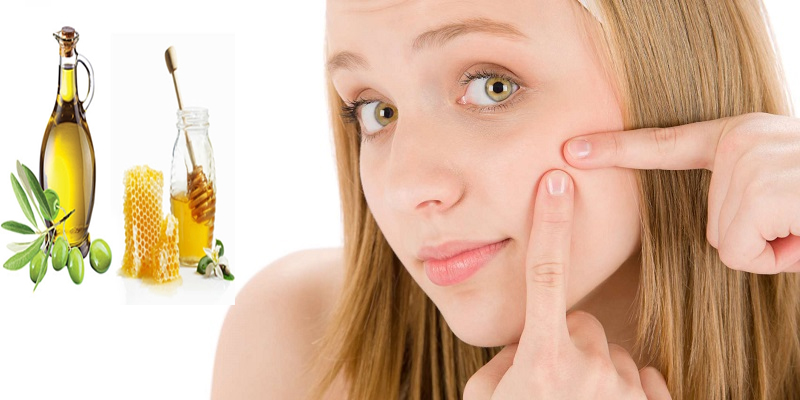 20 Mặt nạ trị mụn tại nhà tốt nhất từ nguyên liệu thiên nhiên dễ kiếm - 7