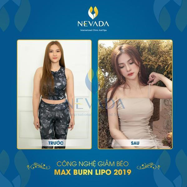 Ca sĩ Thu Thủy sau khi giảm cân bằng công nghệ Max Burn Lipo
