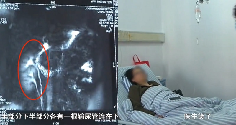 Phát hiện mình có 3 quả thận, người phụ nữ quyết định tặng cho những ai cần - 1
