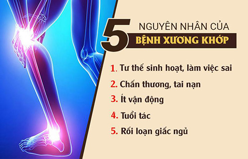 Đau nhức xương khớp là bệnh gì? Nguyên nhân, cách chữa hiệu quả để thoải mái vận động - 3