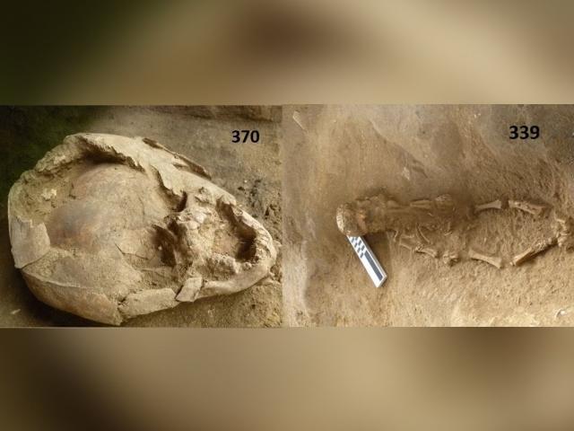 Thế giới - Phát hiện hài cốt trẻ sơ sinh đội loại “mũ bảo hiểm” kì dị chưa từng thấy