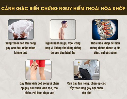Thoái hóa khớp gối là gì? Triệu chứng, cách chữa hiệu quả để không còn đau nhức - 2