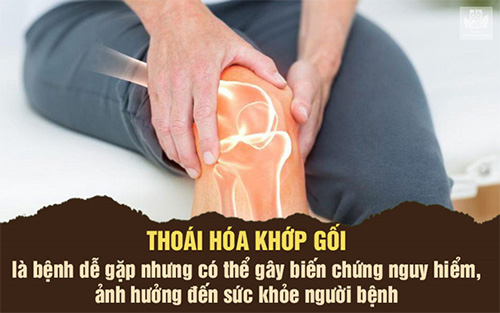 Thoái hóa khớp gối là gì? Triệu chứng, cách chữa hiệu quả để không còn đau nhức - 1