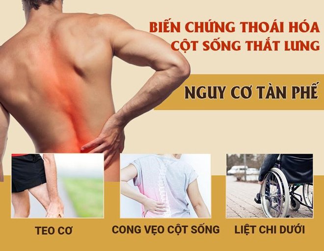 Thoát vị đĩa đệm cột sống thắt lưng: Triệu chứng, cách chữa giúp người bệnh vận động linh hoạt - 2