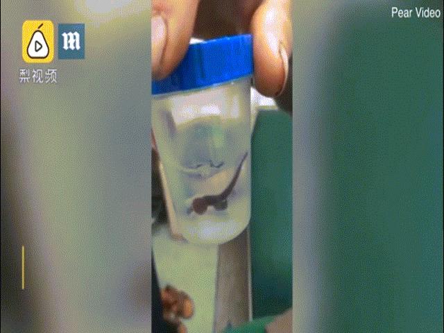 Phi thường - kỳ quặc - Ho không ngừng suốt 2 tháng, đi khám tá hỏa phát hiện con vật kinh dị sống trong mũi và họng