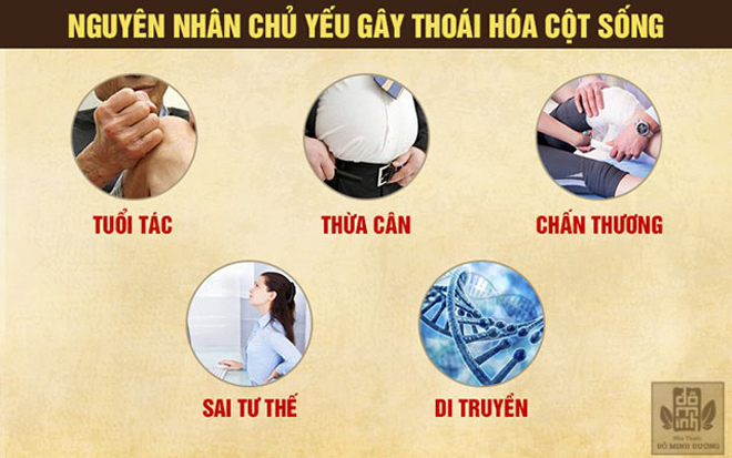 Thoái hóa đốt sống lưng: Triệu chứng, bài thuốc chữa hiệu quả từ thảo dược ngăn nguy cơ tàn phế - 2