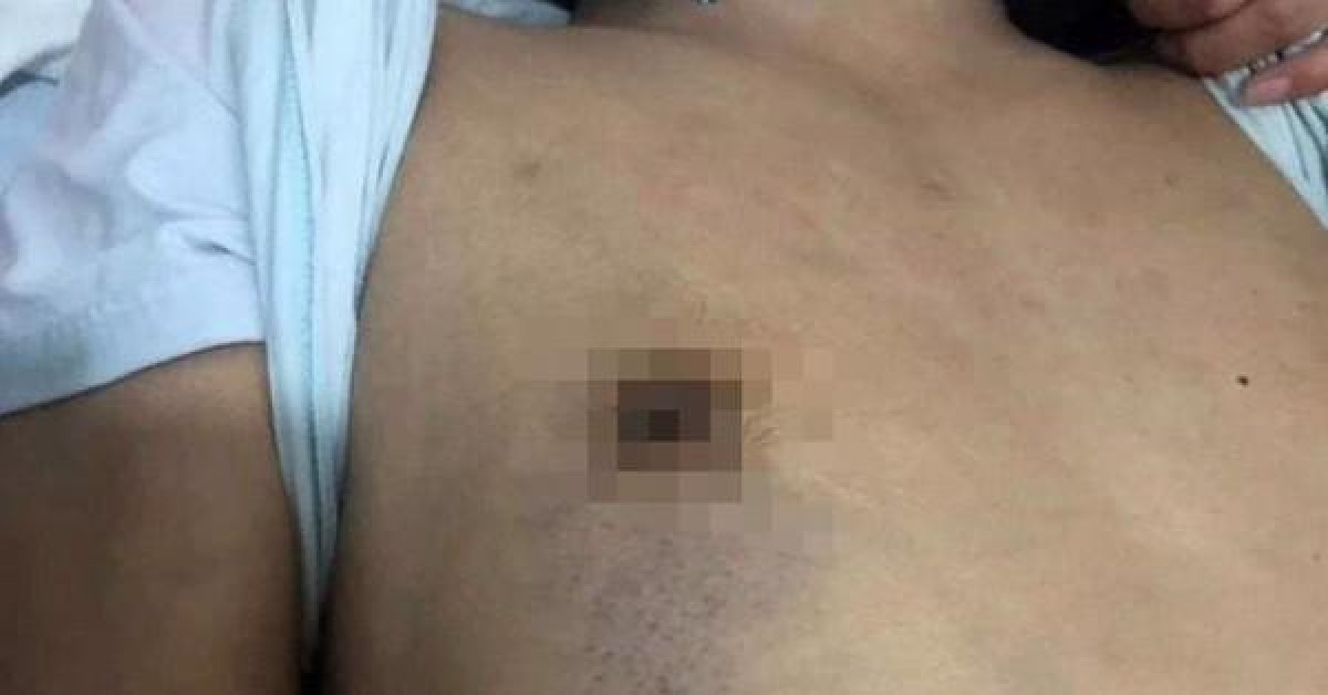 Pháp luật - Công bố nguyên nhân bị can vụ môi giới mại dâm tử vong trong thời gian tạm giam