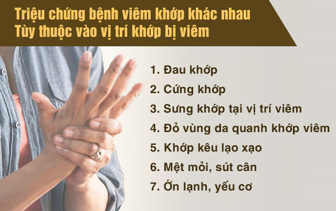 Bệnh viêm khớp: Hiểu nguyên nhân, triệu chứng để điều trị hiệu quả không tái phát - 2