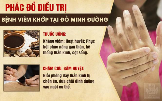 Bệnh viêm khớp: Hiểu nguyên nhân, triệu chứng để điều trị hiệu quả không tái phát - 4