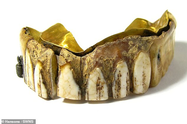 Thợ dò kim loại Peter Cross (59 tuổi) đã phát hiện bộ răng giả rên cánh đồng gần Waterstock Mill, Oxfordshire, Anh. Ảnh DailyMail