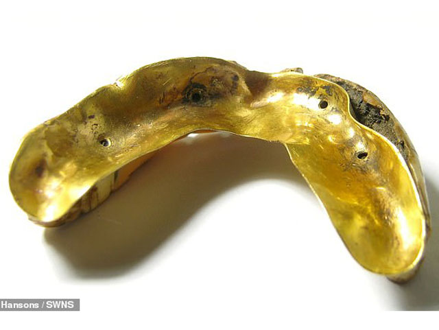 Ban đầu, Peter nghĩ đây là bộ răng cừu cho đến khi ông lau sạch lớp bùn đất và thấy miếng vàng lộ ra. Ảnh DailyMail