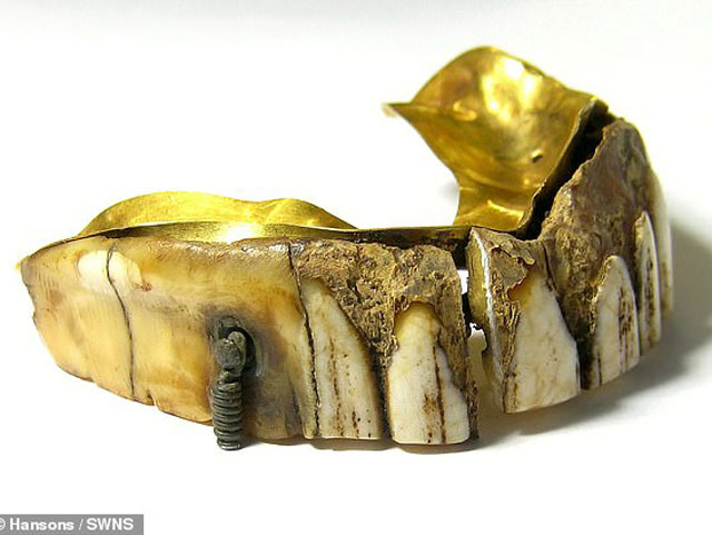 Bộ răng giả khá độc đáo khi kết hợp giữa ngà hà mã hoặc hải mã và vàng. Ảnh DailyMail