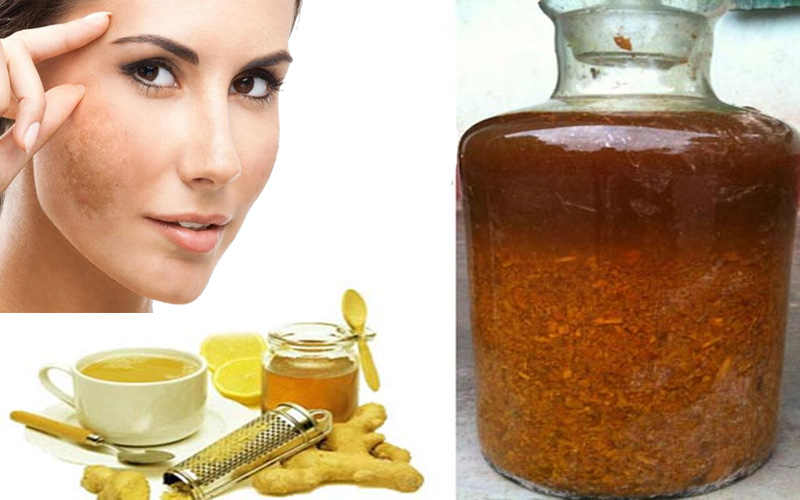 20 Cách trị tàn nhang từ thiên nhiên an toàn hiệu quả tại nhà - 2