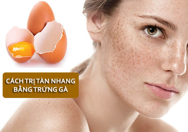 20 Cách trị tàn nhang từ thiên nhiên an toàn hiệu quả tại nhà - 3