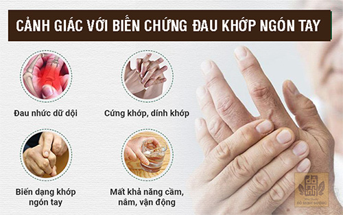 Đau khớp ngón tay: Chuyên gia tư vấn cách chữa hiệu quả, ngừa biến chứng - 2