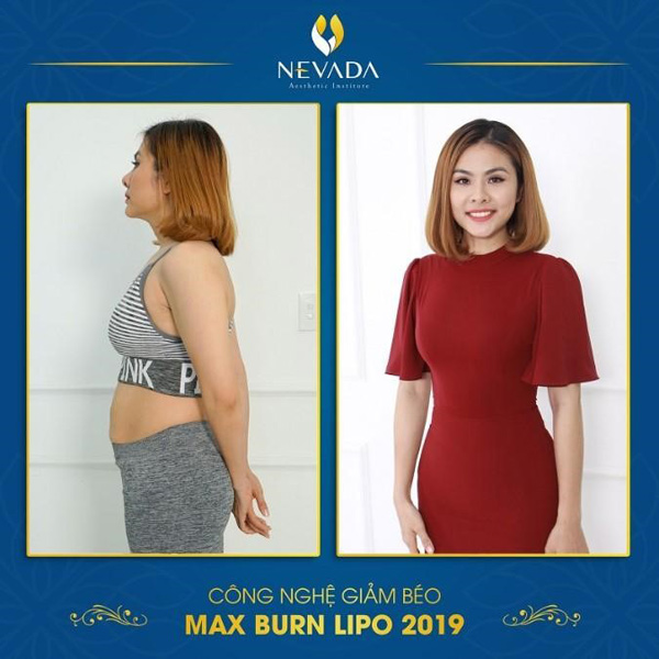 Kết quả của diễn viên Vân Trang sau một liệu trình sử dụng Max Burn Lipo