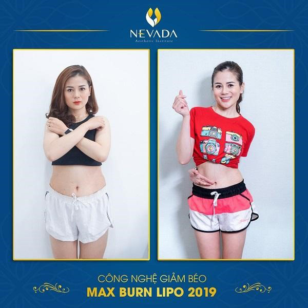 Diên viên Trang Moon trước và sau khi sử dụng Max Burn Lipo