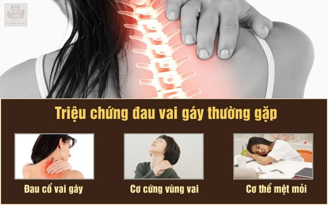 Đau vai gáy là bệnh gì? Nguyên nhân và cách điều trị chấm dứt đau mỏi, ngừa nguy cơ tàn phế - 2